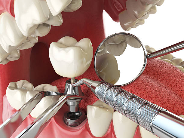 Best Emergency Dental Care for Sports Injuries in Highland Heights, KY